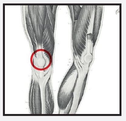 Re+ Techniques - Anterior Knee Pain